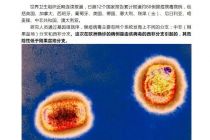 之江生物称公司猴痘病毒核酸检测试剂可准确鉴别猴痘病毒
